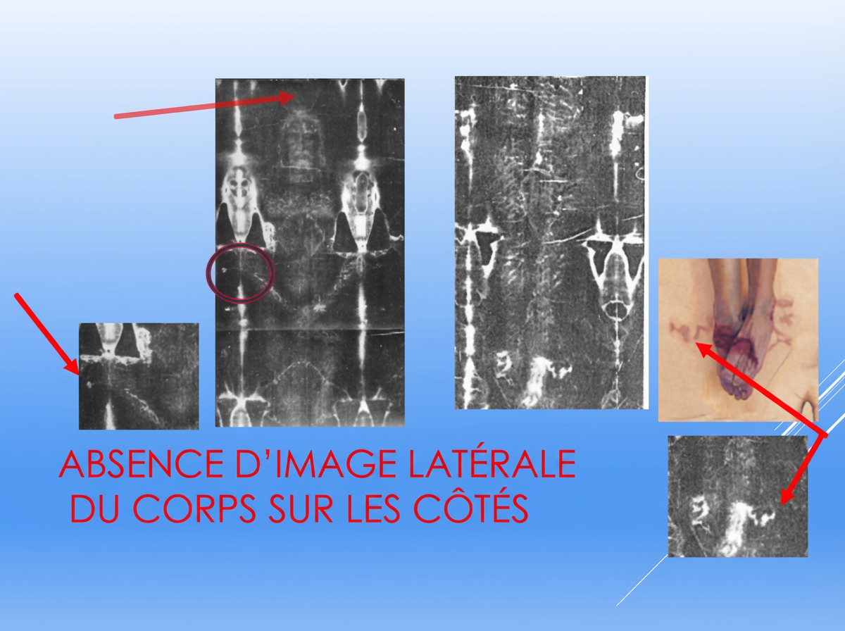 Absence d'image latérale