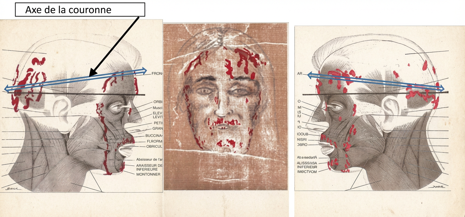 Ecoulements sanguins