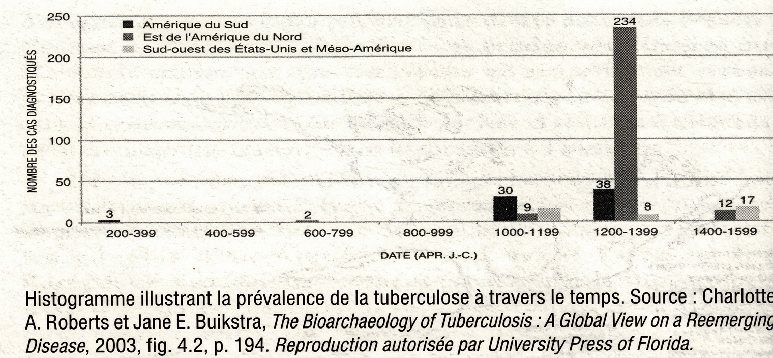 Histogramme de prévalence de la tuberculose