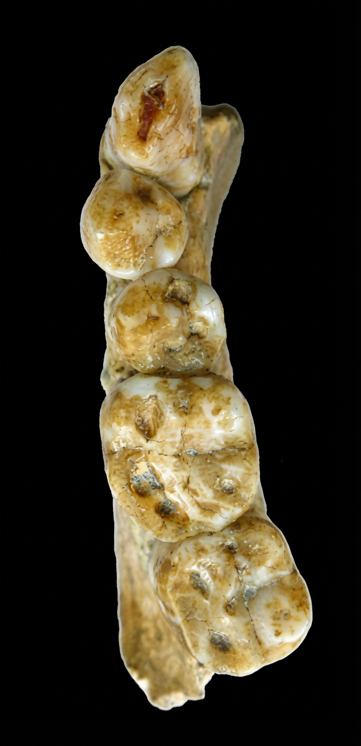 Pointe des molaires abrasée avec formation de cupules