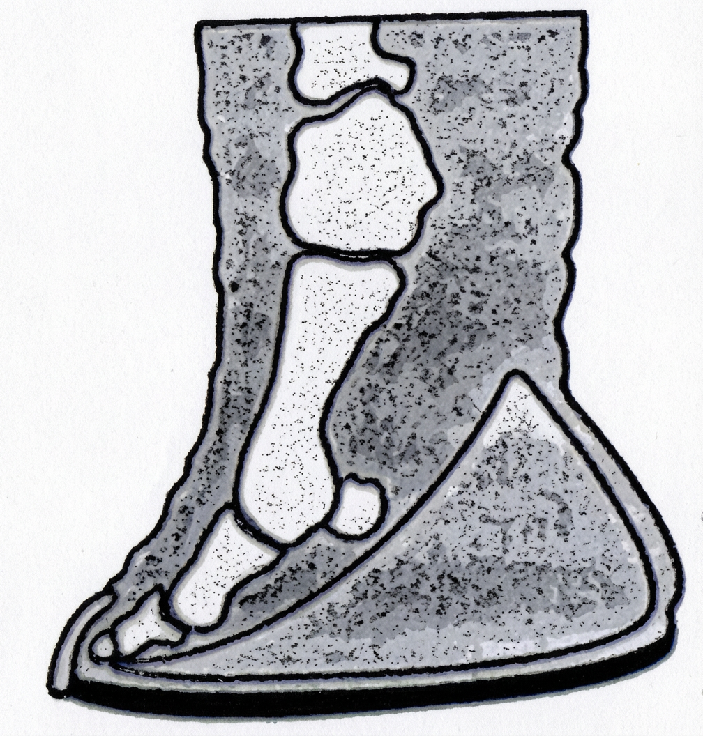Pied d'éléphant