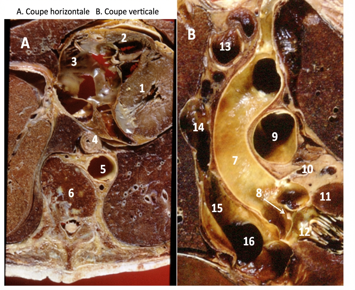 Coupe Horizontale et verticale du coeur humain,