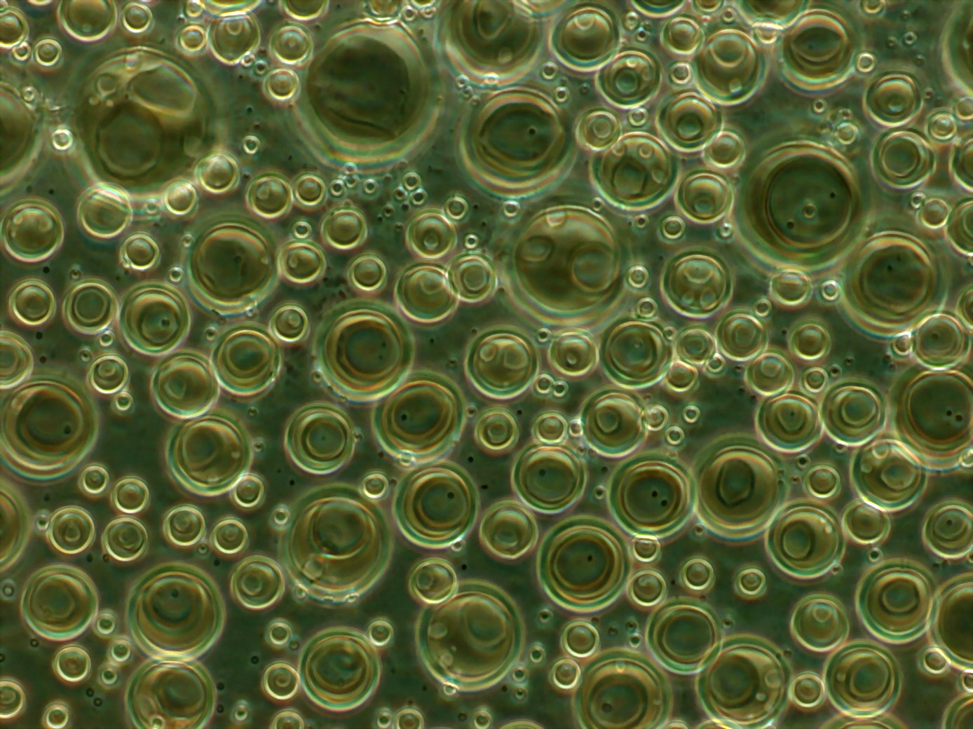 Liposomes observés en microscopie à contraste de phase
